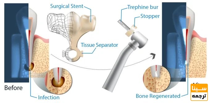 اینفوگرافیک