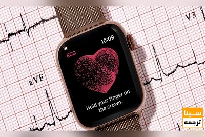 اندازه گیری قند خون با اپل واچ