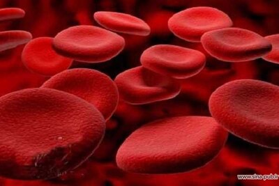 منابع کارشناسی ارشد خون شناسی ازمایشگاهی و بانک خون
